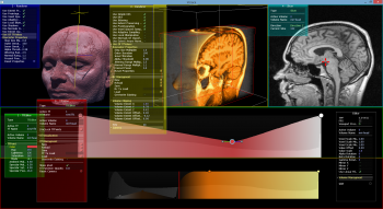 Screenshot aus Voraca. Volumen &quot;MRI Head&quot; von http://www9.informatik.uni-erlangen.de/External/vollib/.